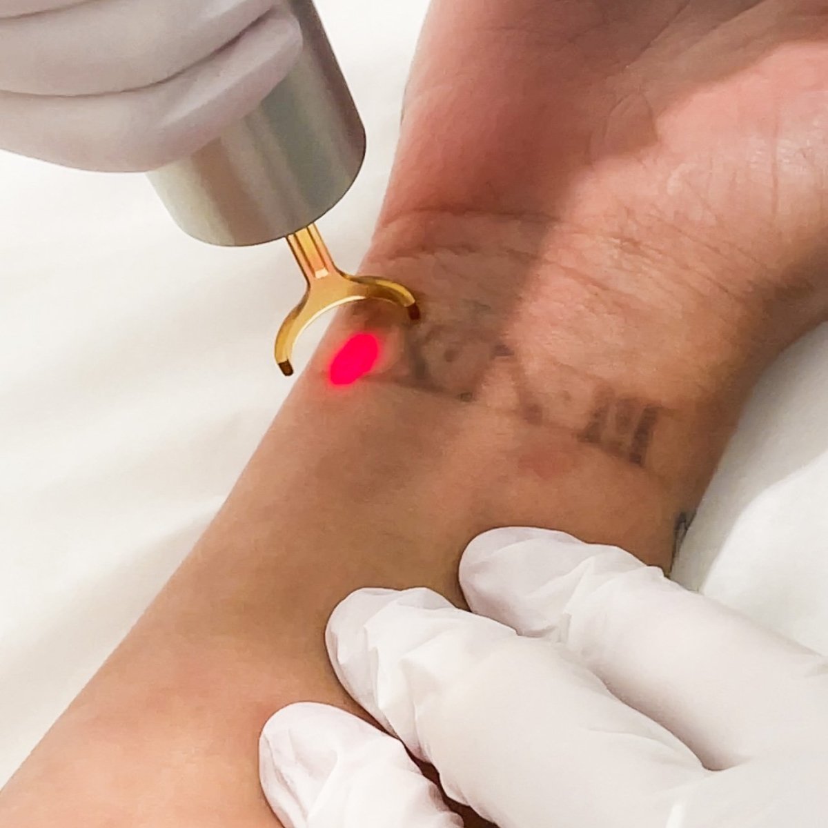 <a href='/laser-tattoo-removal/'>Laser Tattoo Removal</a> Adelaide | Body ink Removal | 100% Safe