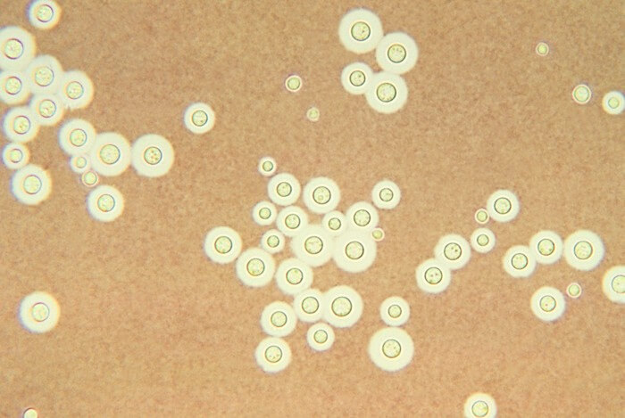 Role of Lipid Composition and Lipid Peroxidation in the Sensitivity of Fungal Plant Pathogens to Aluminum Chloride and Sodium Metabisulfite | Applied and Environmental Microbiology