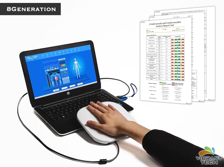 Ultrasonic Silicon Dioxide Dispersion Machine - Element Analyzer - Analysis Instrument - Instruments & Meters - Products - Xxphxz.com