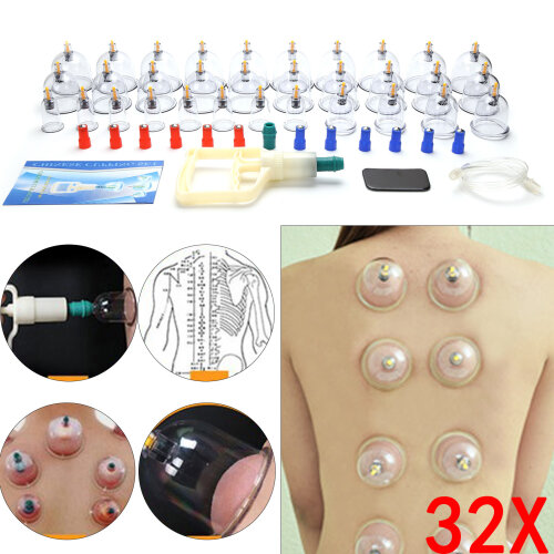 Cupping  Health