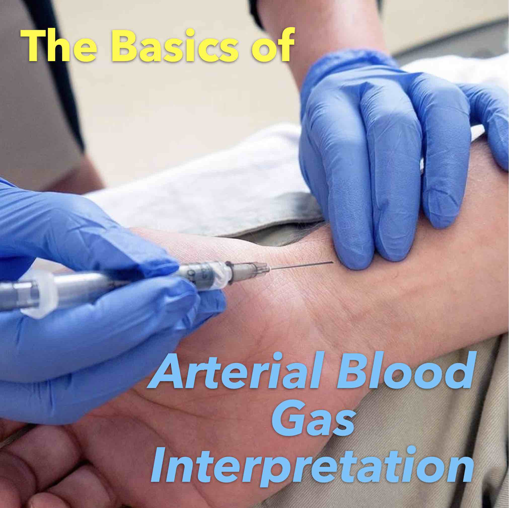 Which of the following gases readily combines with the haemoglobin of the blood? - LeadMCQS