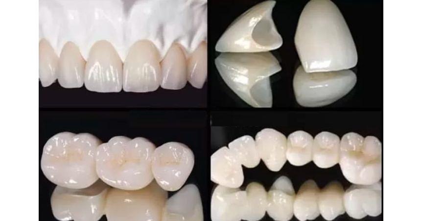 Zirconia  Beautyzir dental