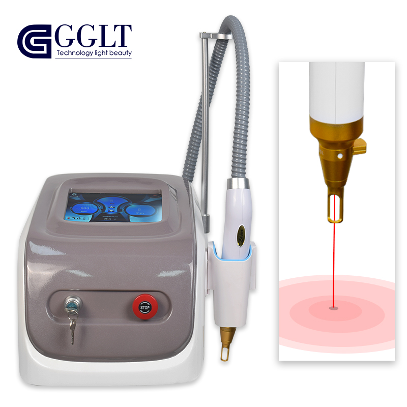 Laser ND YAG <a href='/tattoo-removal/'>Tattoo Removal</a> & Carbon Peeling Machine: Trusted Factory Supplier