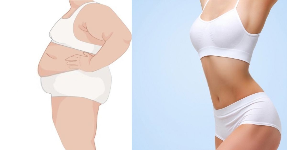 Can You Really Freeze Your Belly Fat Away?