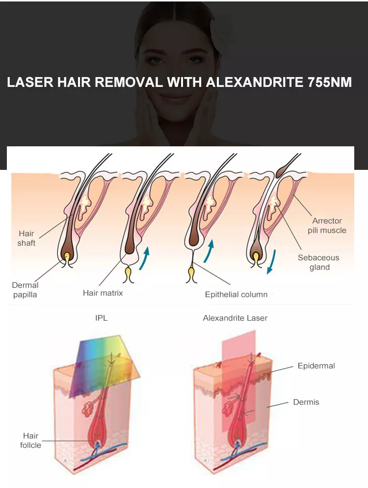 beauty machine hair removal