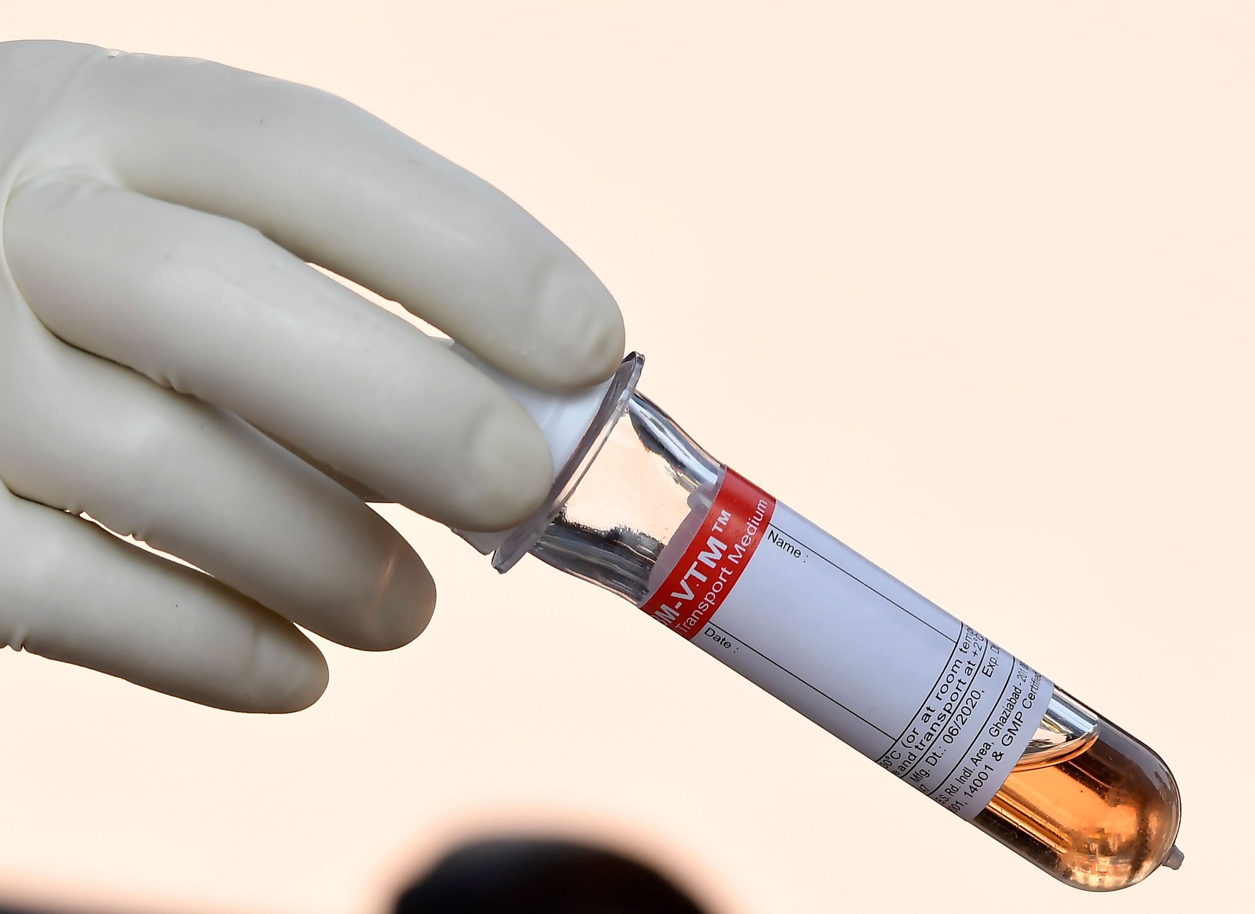 Evaluation of a rapid antigen detection test for Neisseria gonorrhoeae in urine sediment for diagnosis of gonococcal urethritis in males