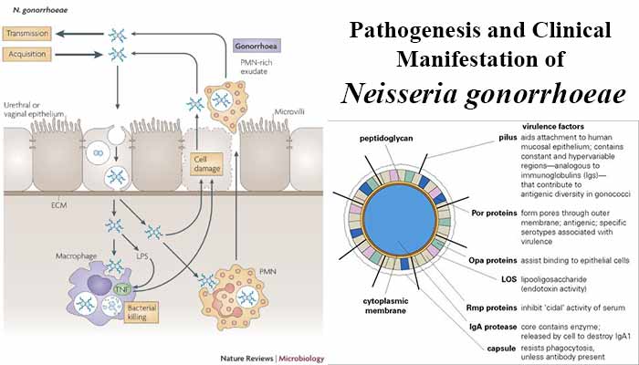 Neisseria gonorrhoeae Genetics & Genomics News | GenomeWeb