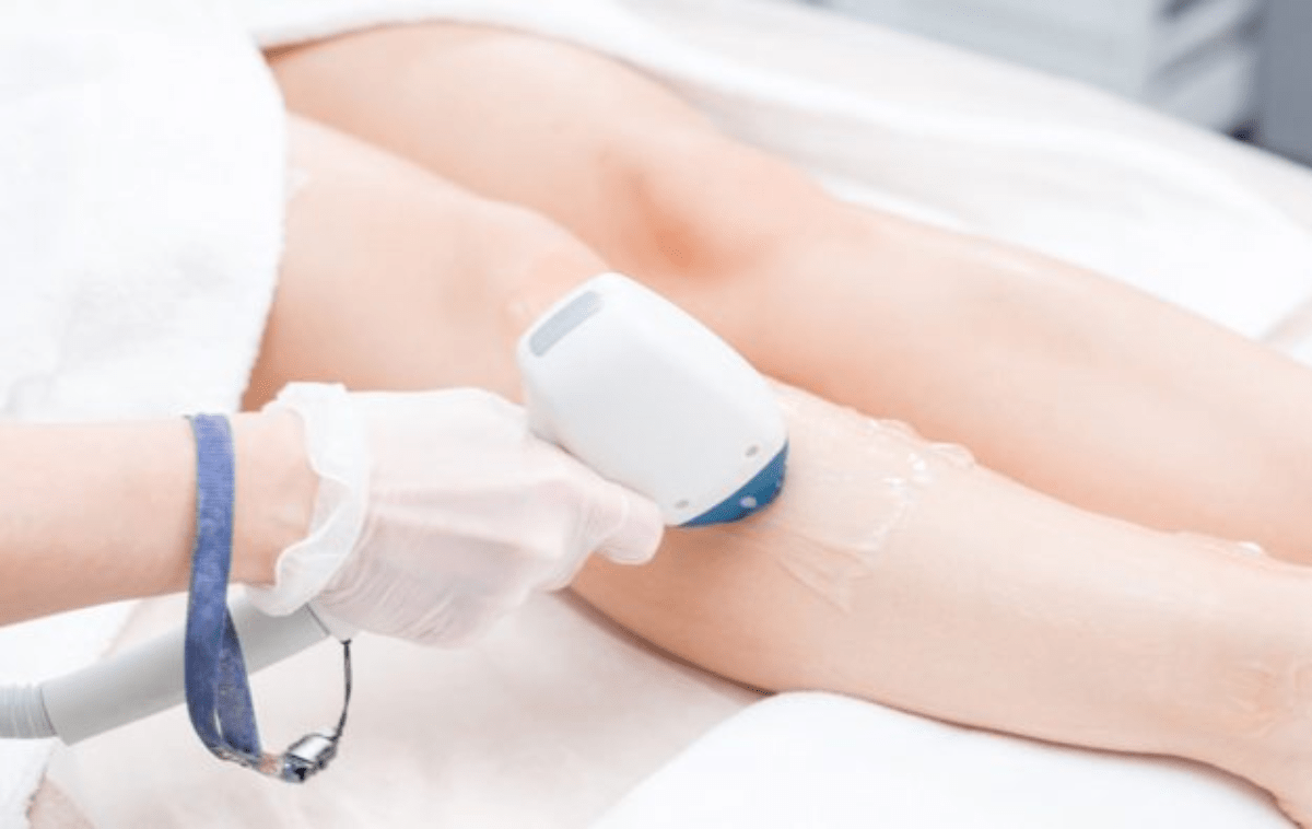 Painless Hair Removal - Thebroketown