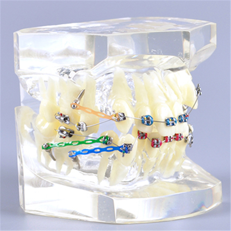 dental orthodontic model with brackets and buccal tubes and ligature wire for practice dental instrument composite model