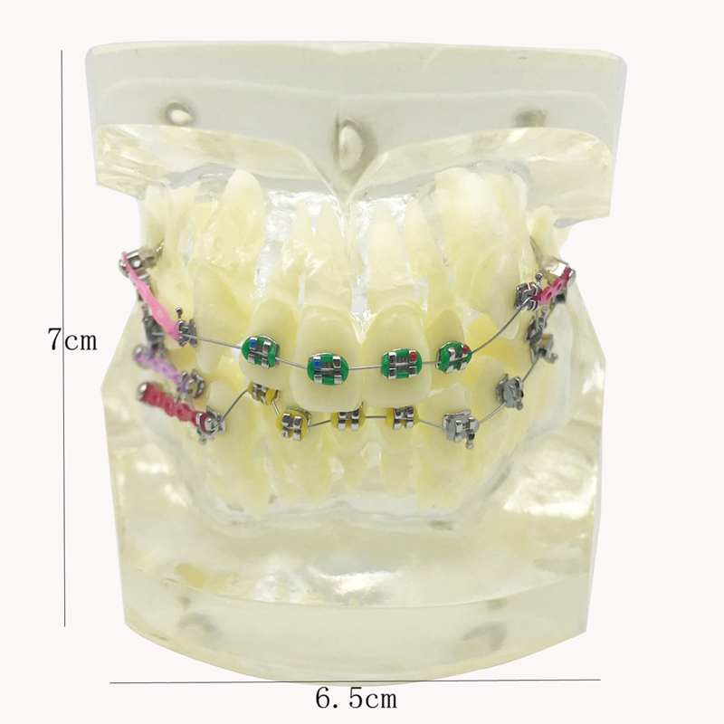 dental orthodontic model with brackets and buccal tubes and ligature wire for practice dental instrument composite model