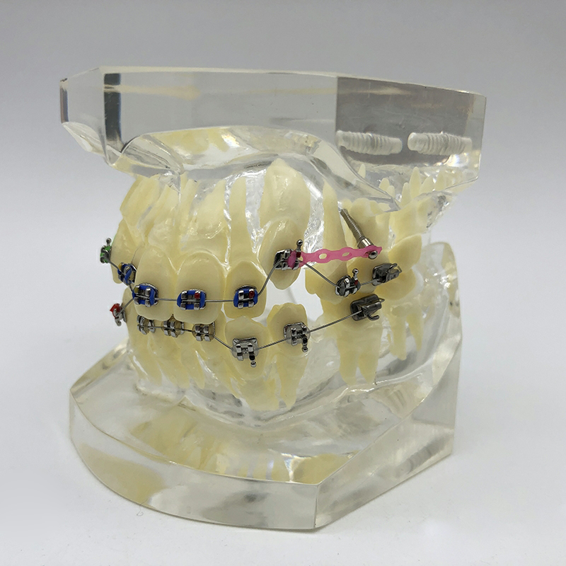 dental orthodontic model with brackets and buccal tubes and ligature wire for practice dental instrument composite model