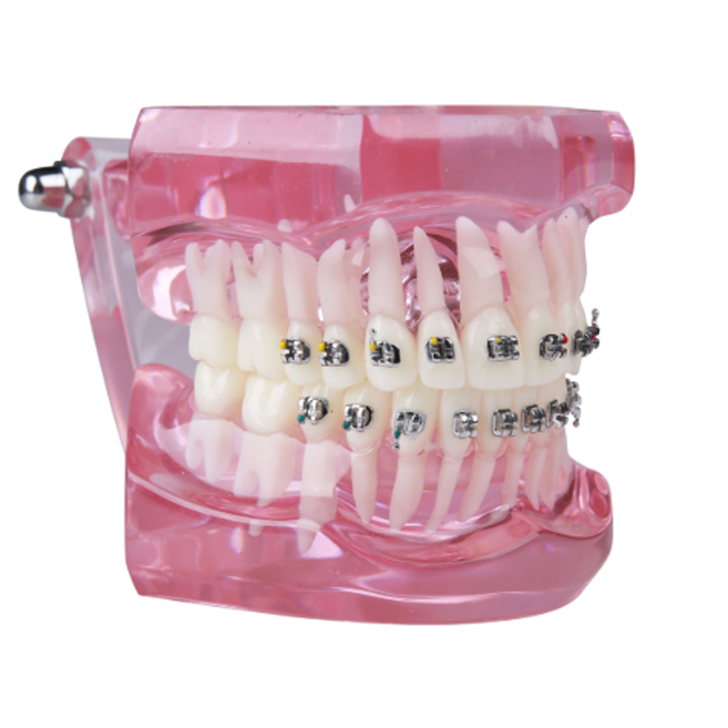 dental demonstration orthodontic model dental practice typodont with all metal bracket dental standard model removable teeth