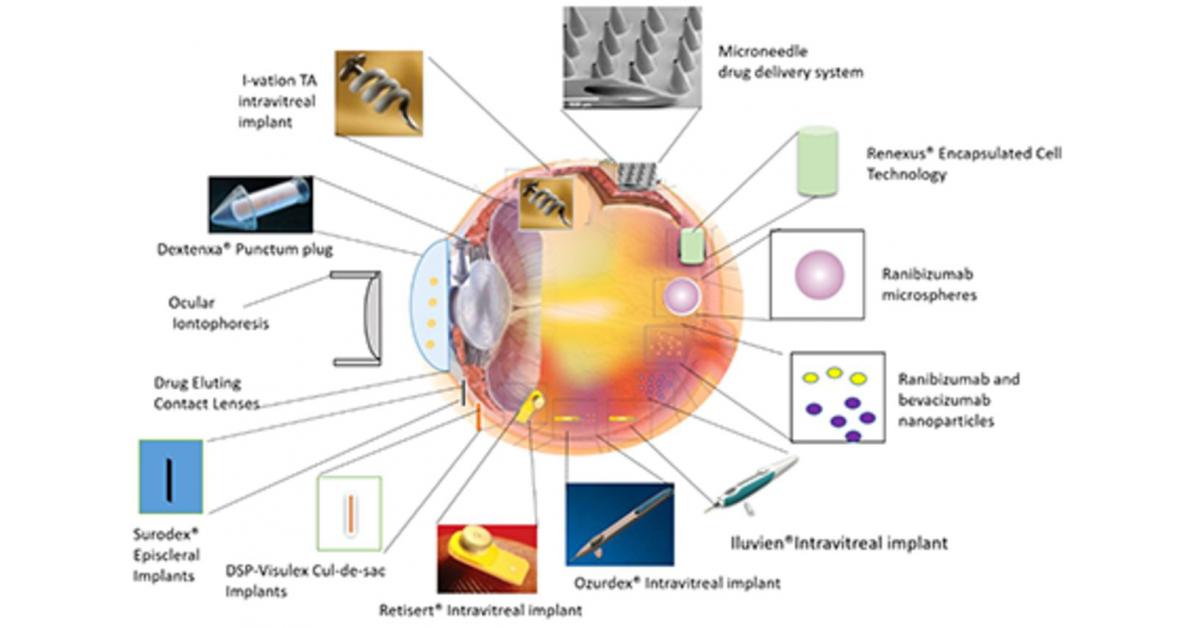 Ocular Therapeutixtm Provides Fourth Quarter And Year-End 20...
    | MENAFN.COM