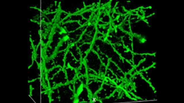 Compound Microscopes | Biological & High Power Microscopes