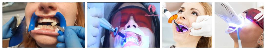 curing-light-for-teeth