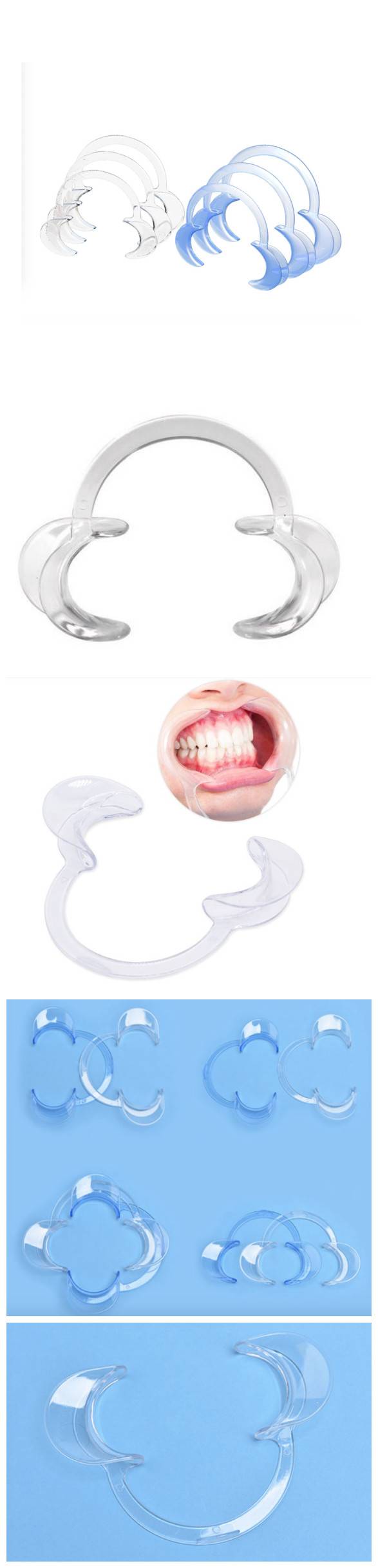 teeth-whitening-mouth-retractors