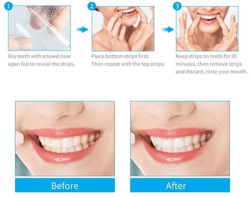 teeth-whitening-strip-04