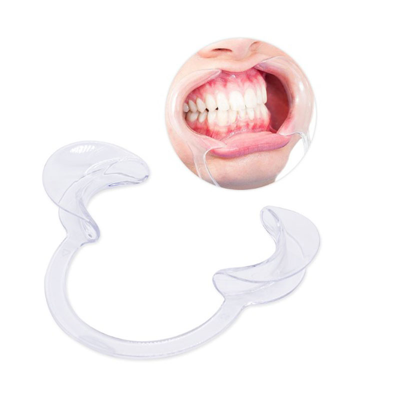Dental mouth retractor for teeth whitening