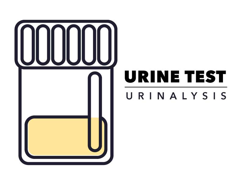 Urine Test