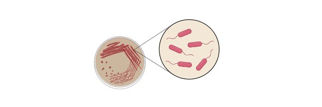 Hematocrit Test: Uses, Procedure, and Results