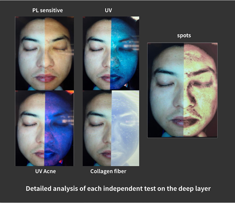 New-Skin-analyzer_08