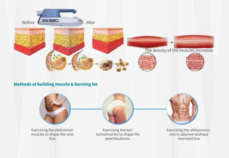 emsculpt machine3