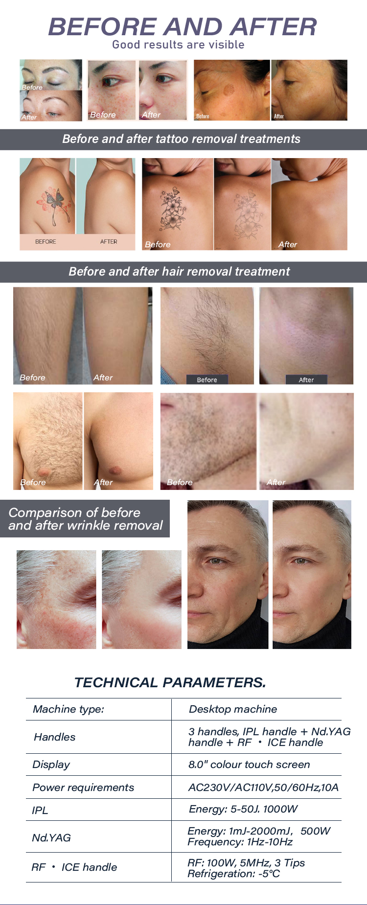 hair removal skin rejuvenation before and after