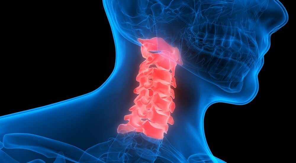 Cervical (Neck) Implants used in Spine Surgery