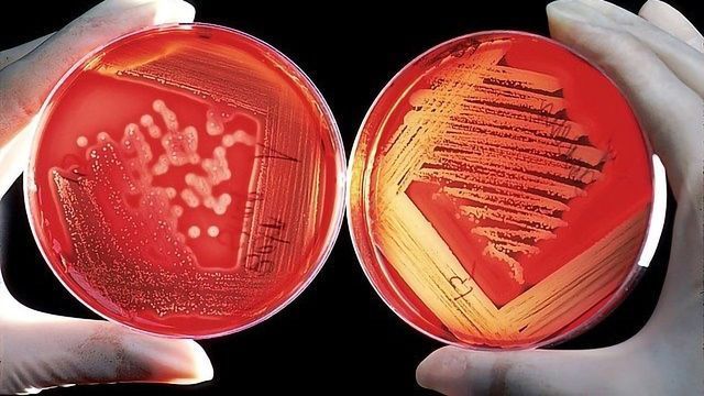 Community DNA Extraction from Bacterial Colonies | Protocol (Translated to German)