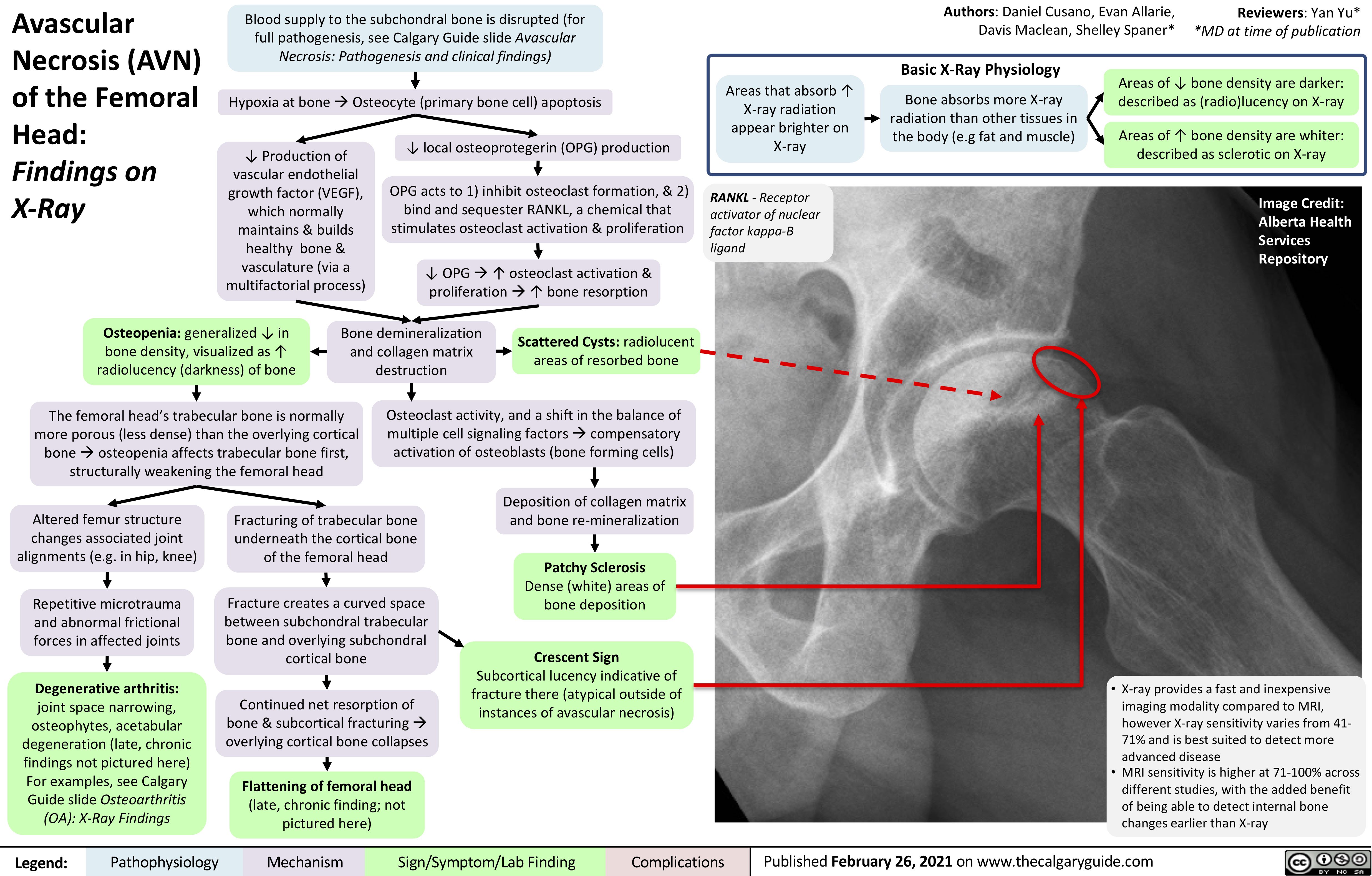 Fracture of a Femoral Revision Stem following a Technical Failure