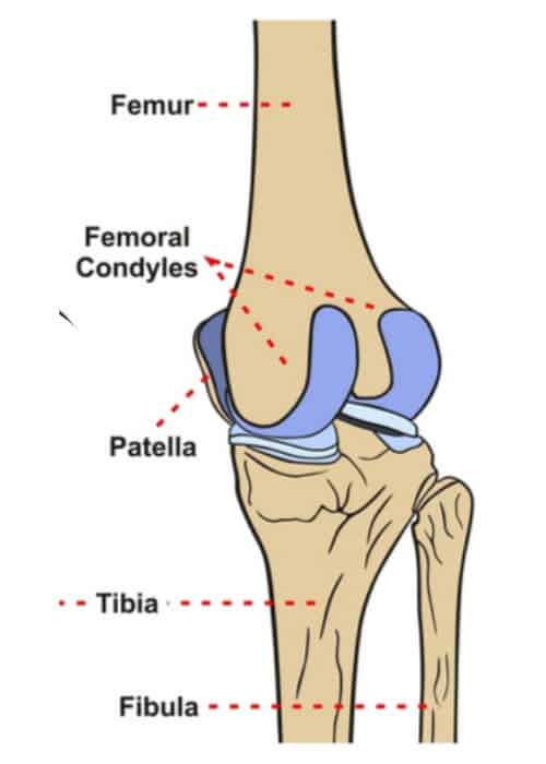 Cemented femoral stem - MAGNUS - Ortosintese