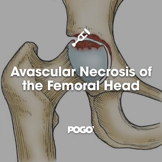 Femoral | definition of femoral by Medical dictionary